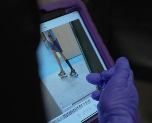 lower limb bracing