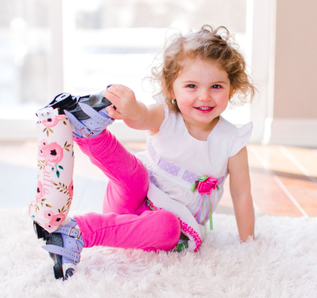 clubfoot bracing products featured product image